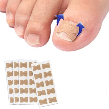 Наклейки для коррекции ногтей Средство для лечения Паронихии Восстанавливающий Корректор Инструменты для педикюра